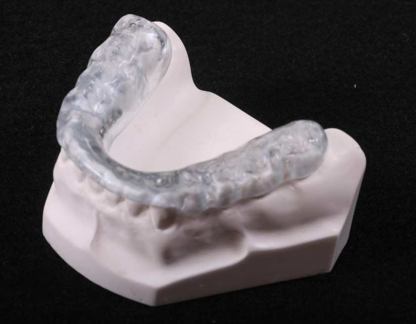 TMJ Doctor in American Fork, UT TMJ Oral Appliances